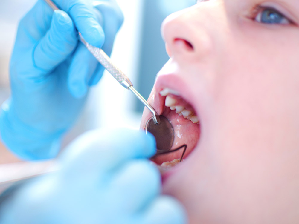 Trẻ em bị đau sâu răng sữa thì phải đến nha khoa để được khám chi tiết 