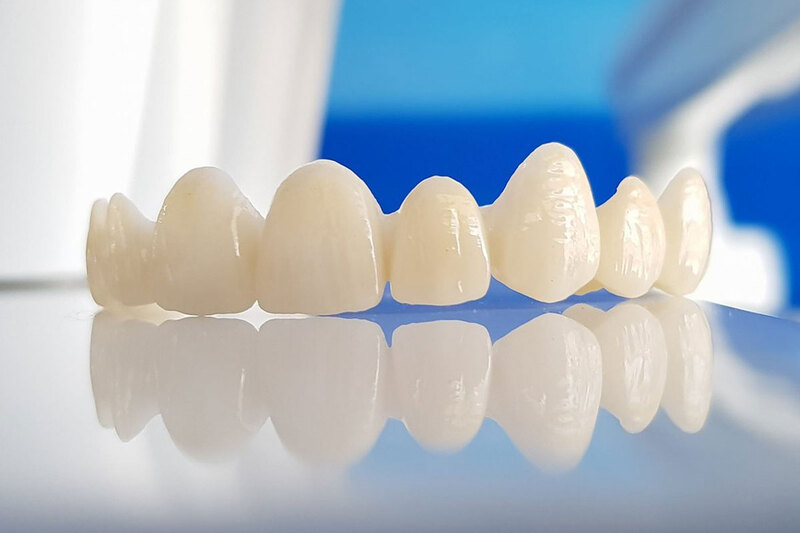 Độ bền của răng sứ phụ thuộc vào yếu tố nào?
